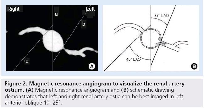 interventional-cardiology-Magnetic-resonance