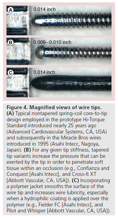 interventional-cardiology-Magnified-views