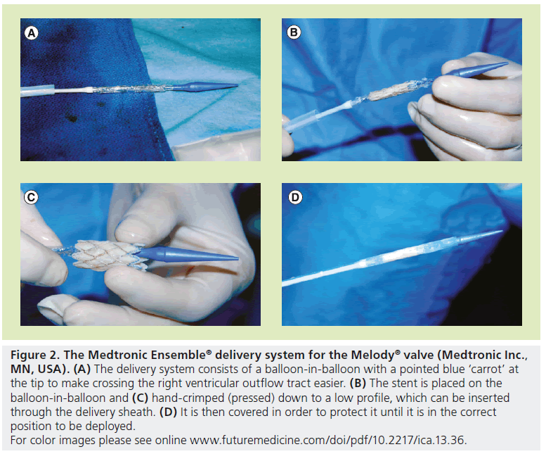 interventional-cardiology-Medtronic-Ensemble