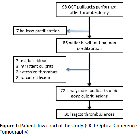 interventional-cardiology-Optical-Coherence