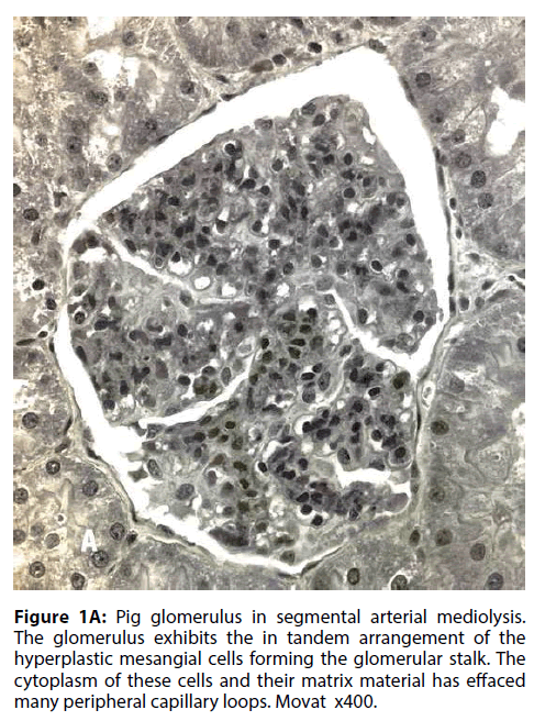 interventional-cardiology-Pig-glomerulus
