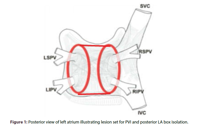 interventional-cardiology-Posterior-view-left-atrium