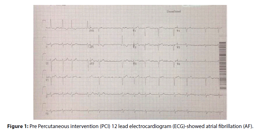 interventional-cardiology-Pre-Percutaneous