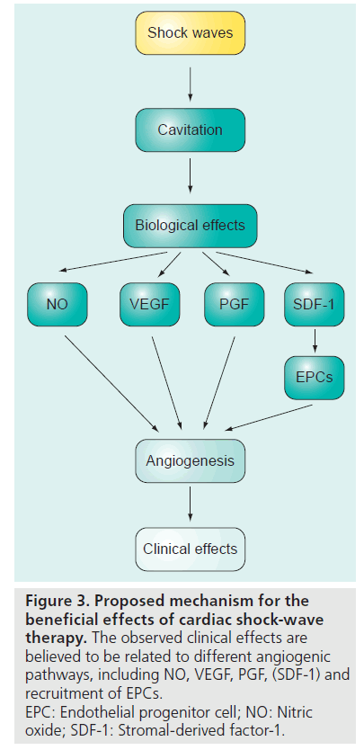 interventional-cardiology-Proposed-mechanism