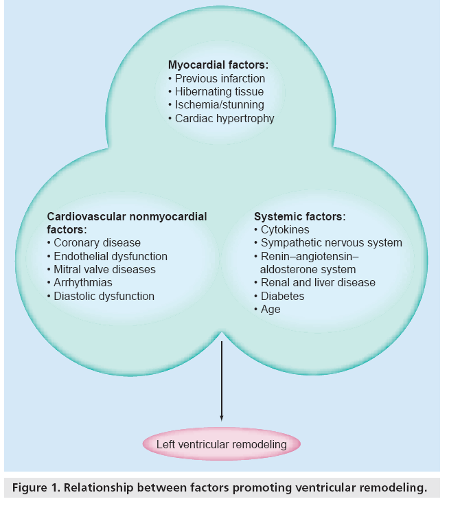 interventional-cardiology-Relationship-between