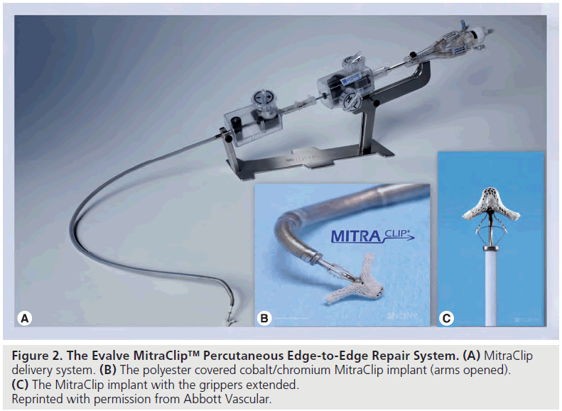 interventional-cardiology-Repair
