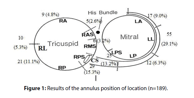 interventional-cardiology-Results-annulus