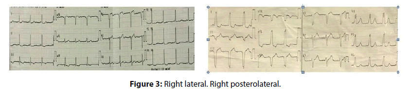 interventional-cardiology-Right-lateral