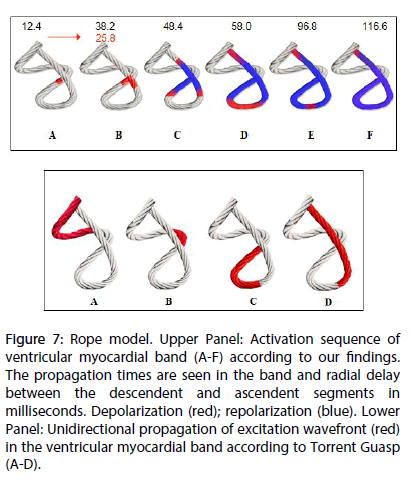 interventional-cardiology-Rope-model