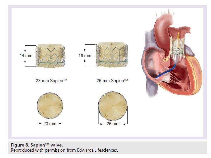 interventional-cardiology-Sapien