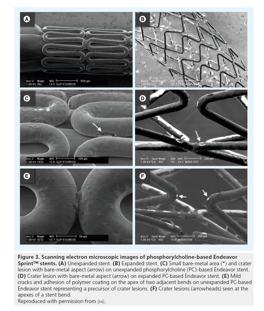 interventional-cardiology-Scanning-electron