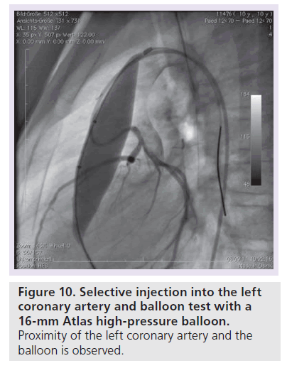 interventional-cardiology-Selective-injection