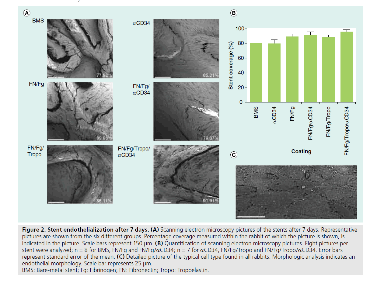 interventional-cardiology-Stent-endothelialization
