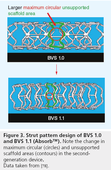 interventional-cardiology-Strut-pattern-design