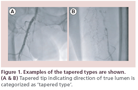 interventional-cardiology-Tapered-tip-indicating