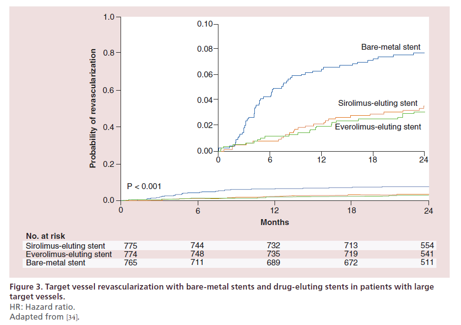 interventional-cardiology-Target-vessel