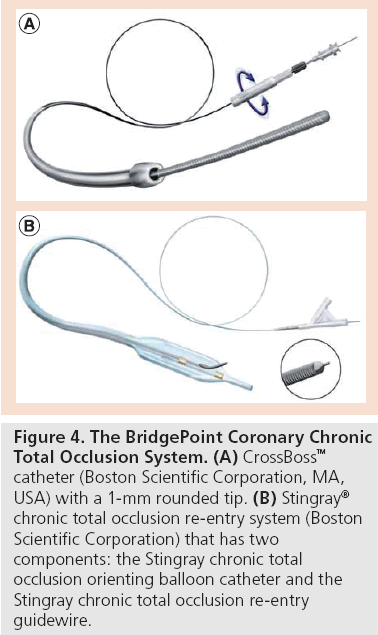 interventional-cardiology-Total-Occlusion-System