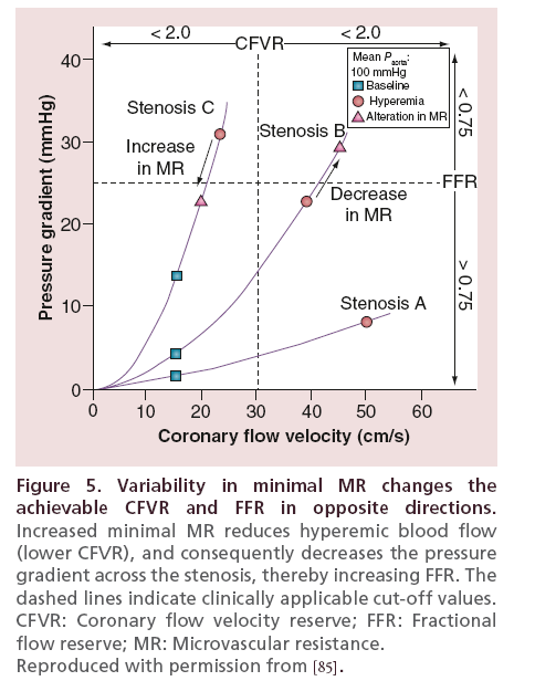 interventional-cardiology-Variability-minimal