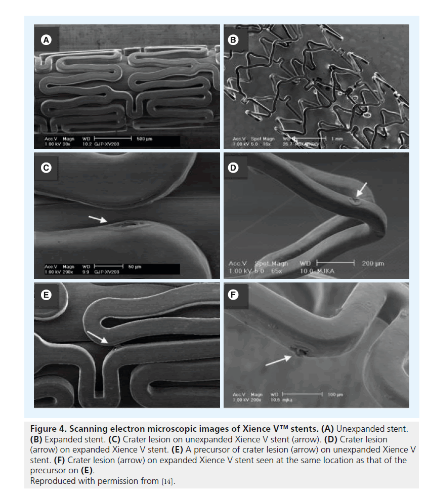 interventional-cardiology-Xience