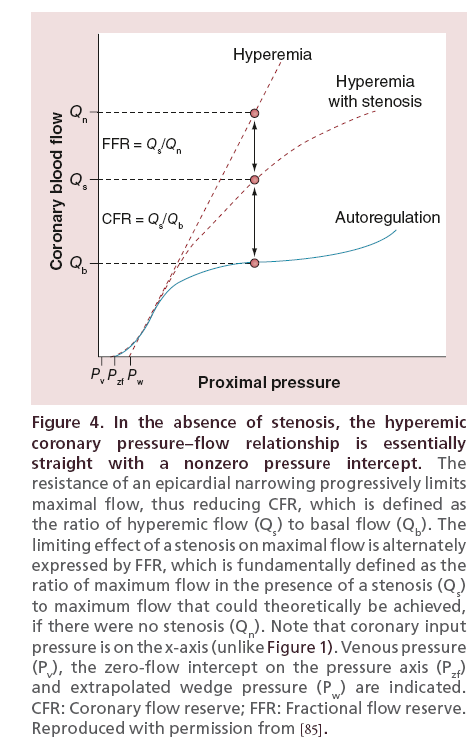 interventional-cardiology-absence-stenosis