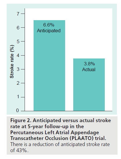 interventional-cardiology-actual-stroke