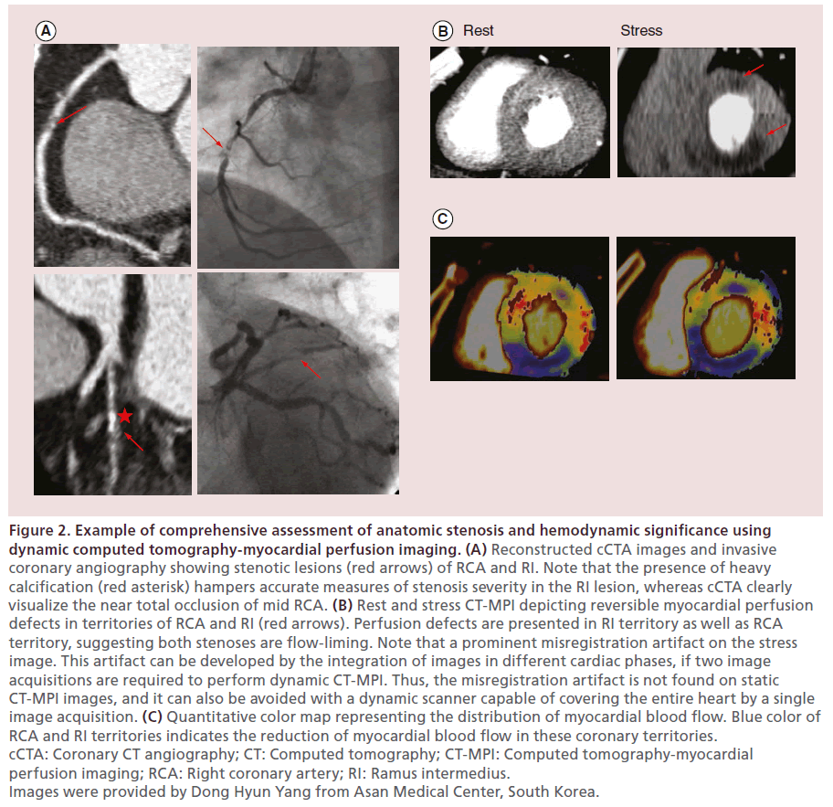 interventional-cardiology-anatomic