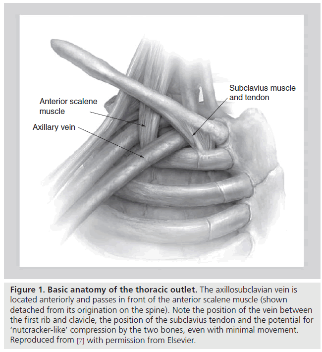 interventional-cardiology-anatomy-outlet