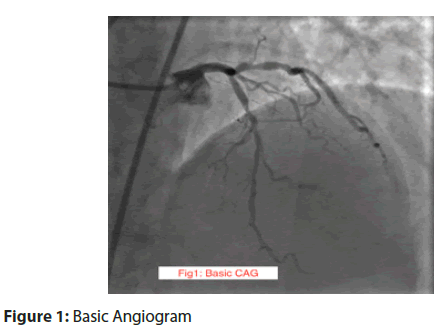 interventional-cardiology-angiogram