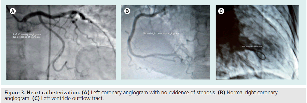 interventional-cardiology-angiogram