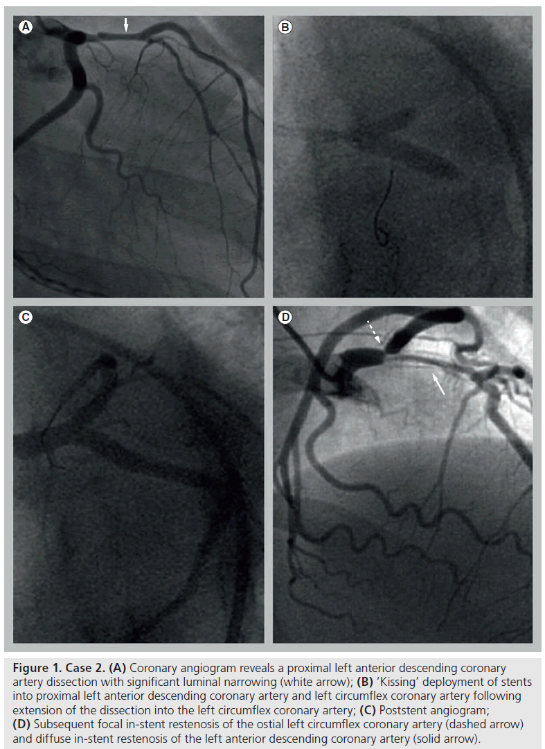 interventional-cardiology-angiogram