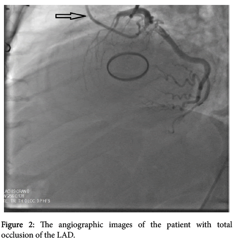 interventional-cardiology-angiographic-images