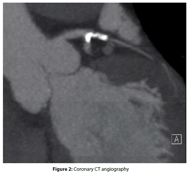 interventional-cardiology-angiography