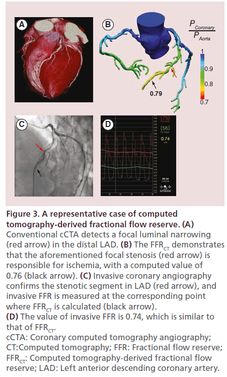 interventional-cardiology-angiography