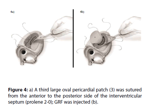 interventional-cardiology-anterior-posterior