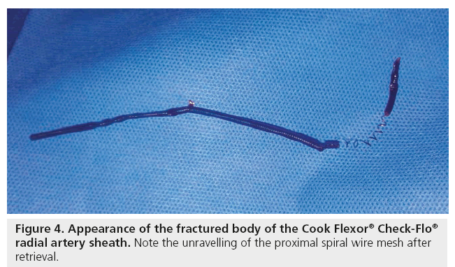 interventional-cardiology-appearance-fractured