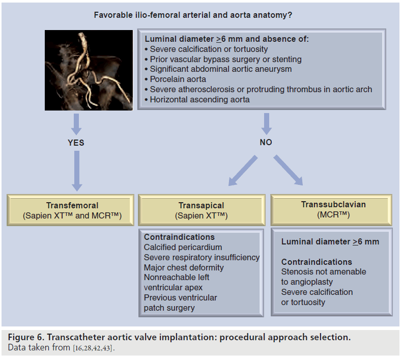 interventional-cardiology-approach