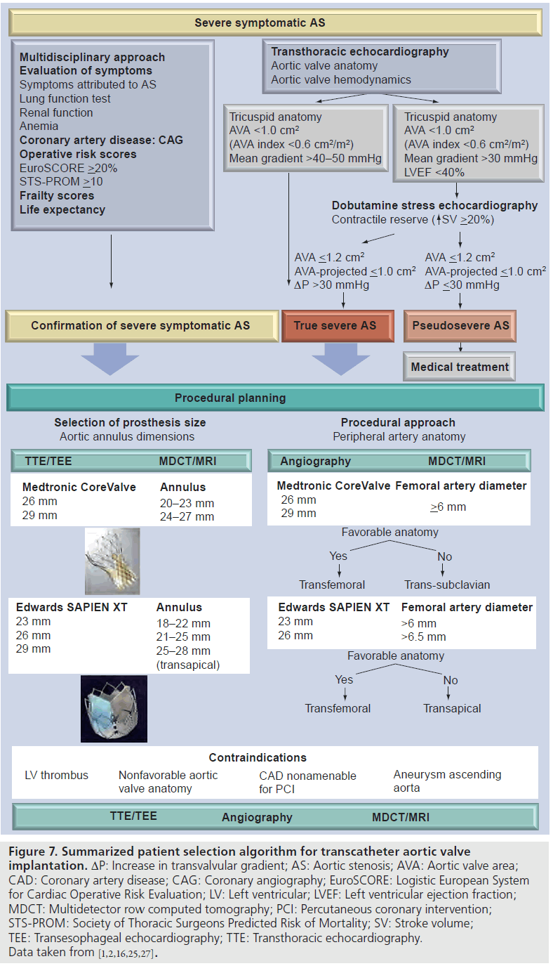 interventional-cardiology-approach