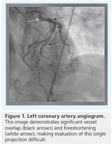 interventional-cardiology-artery-angiogram