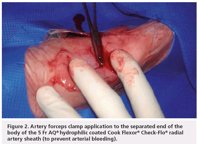 interventional-cardiology-artery-forceps