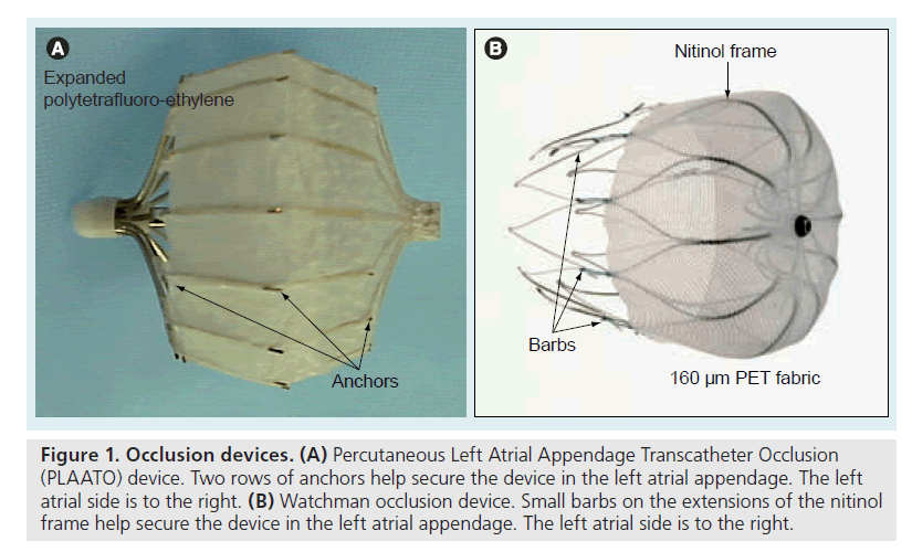 interventional-cardiology-atrial-appendage