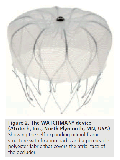 interventional-cardiology-atrial-face