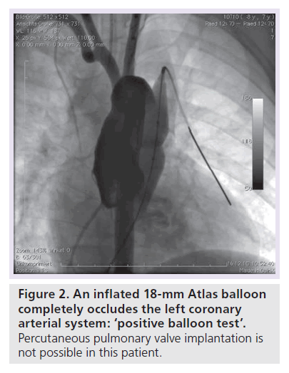 interventional-cardiology-balloon-test