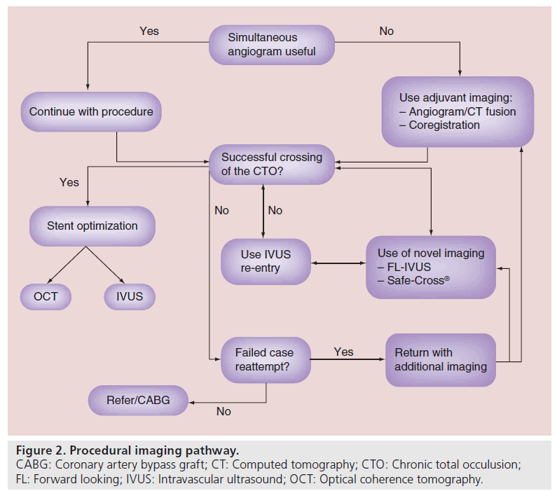 interventional-cardiology-bypass-graft