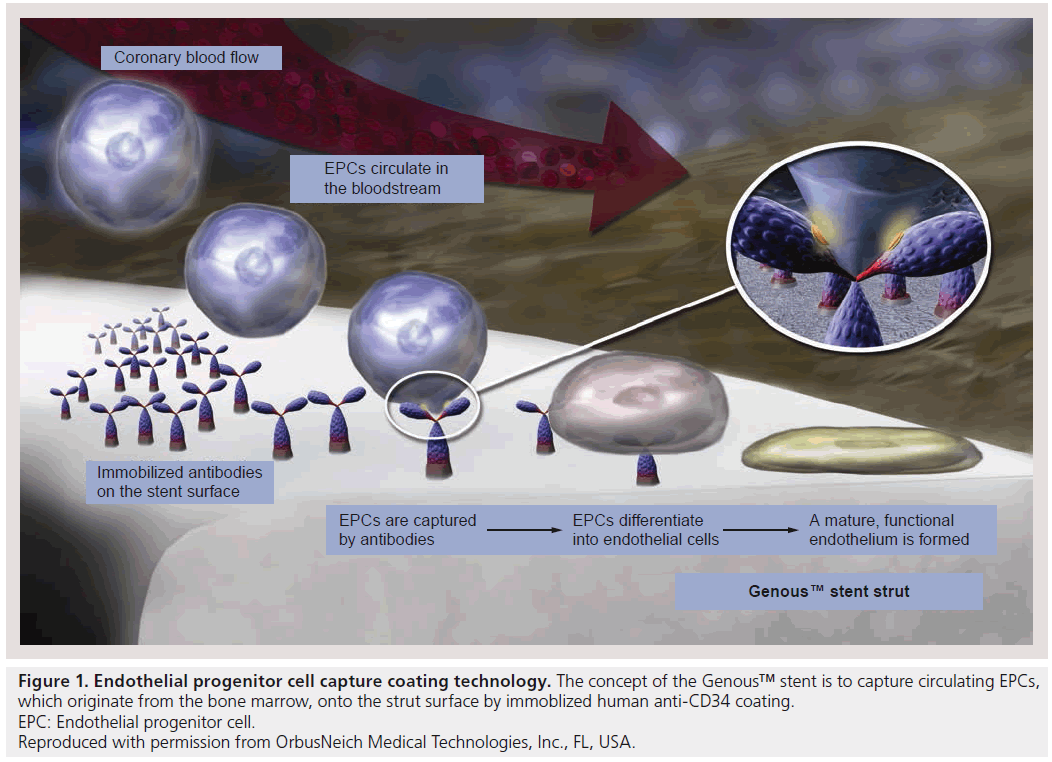 interventional-cardiology-capture-bone