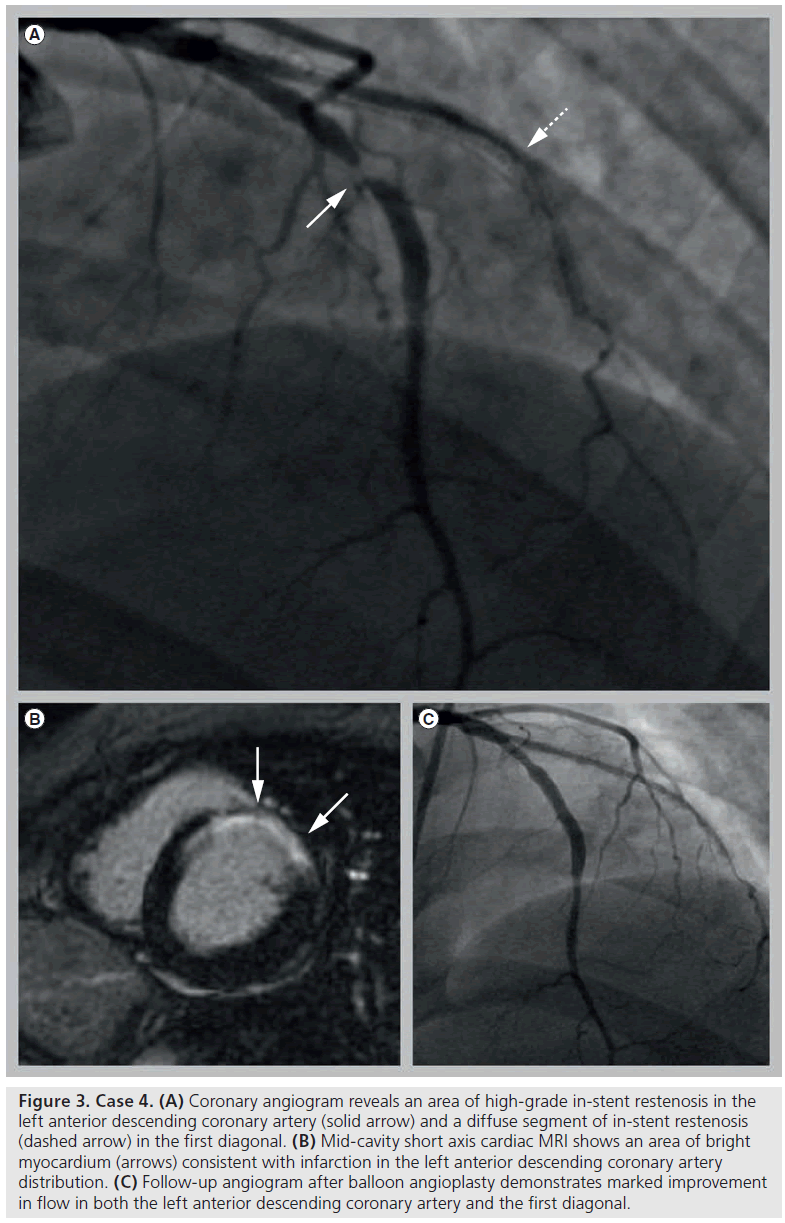 interventional-cardiology-cardiac