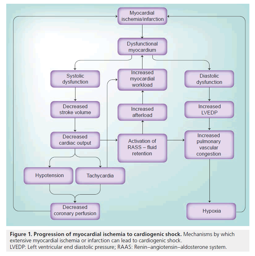 interventional-cardiology-cardiogenic-shock