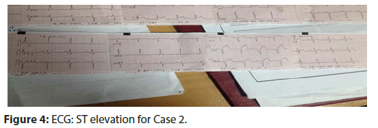 interventional-cardiology-case