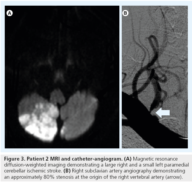 interventional-cardiology-catheter-angiogram