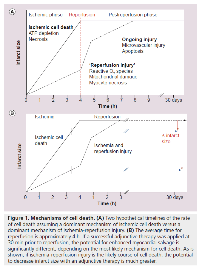 interventional-cardiology-cell-death