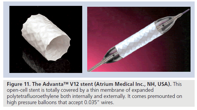 interventional-cardiology-cell-stent